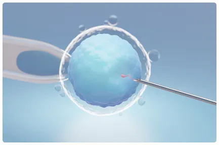 Understanding ICSI: A solution for male factor infertility in Pune