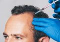 Get the Facts About Hair Restoration with PRP Therapy